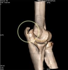 سی تی اسکن , ct scan